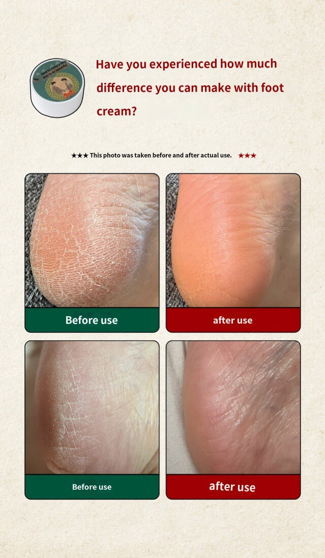 SHEGAIA Beauty Foot Cream 150g