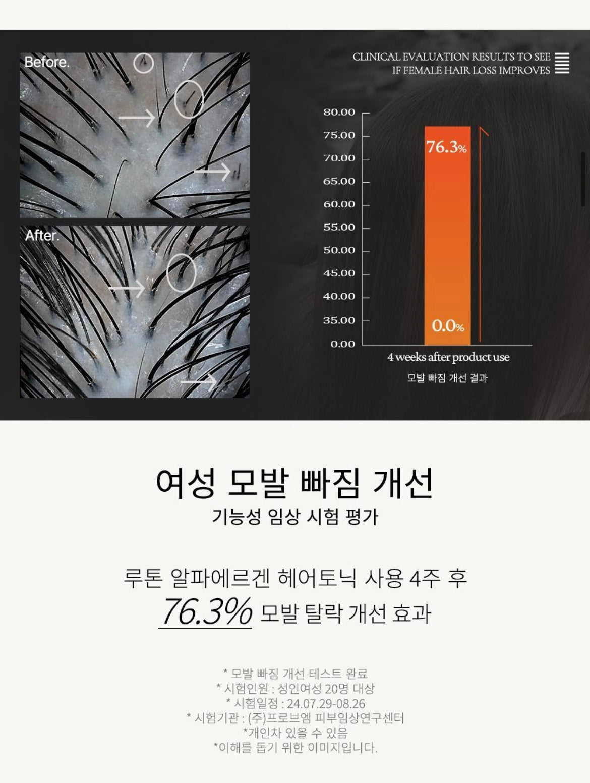 Rooton Women Hair Care Alpha erguen Hair Tonic 150ml + Shampoo 70ml